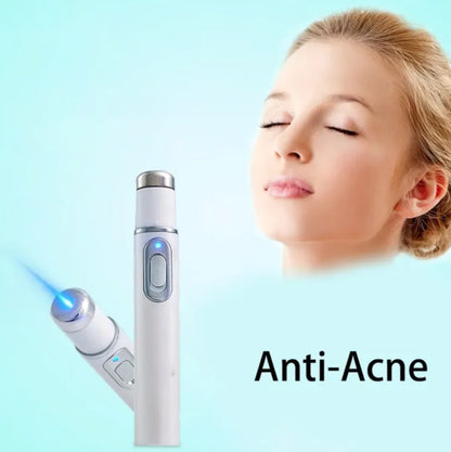 Blue Light Therapy Acne Pen